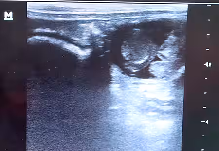 Im Ultraschall sieht man oben rechts 2 Kaninchenbabys (Föten).